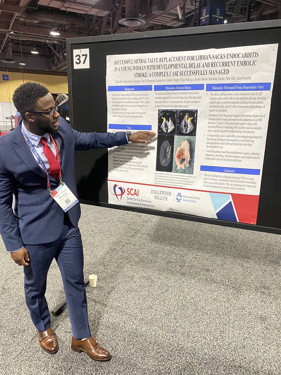 iiam_tejiri's tweet photo. Excited to present my case on treating Libman-Sacks endocarditis in a patient with developmental delay and recurrent stroke. Grateful for the opportunity to network with leaders like @AGoldsweig one of the Chairs of SCAI #Cardiology #SCAI2024 #engleim #CardioTwitter @Cezenna_MD https://t.co/pEv6z7XtBO