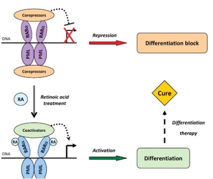 Differentiation syndrome 

Occurs in 25% of APML treated with ATRA. 

Maturation of promyelocytes into PMNs causes cytokine release and vascular leak. 

Occurs 7-12 days (median) after induction. 

Sxs
⭐️Fever
⭐️Dyspnea
⭐️Volume overload
⭐️AKI
⭐️Hypotension 
⭐️DAH

Tx: Steroids