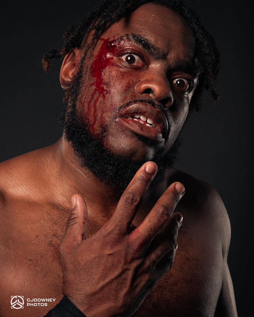 👨‍⚕️ This past Sunday, AML Wrestling Champion Brad Attitude busted Zuka King open.🩸After the event, Zuka King was rushed to a local medical facility where he received stitches. 📸 Photo by CJ Downey #AMLWrestling