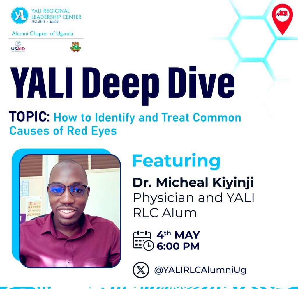 The Health Ministry declared an outbreak of red eyes in Uganda in March this year with the most affected areas being schools & prison facilities within Kampala.

The disease has since spread to various districts across the country. There are myths and facts surrounding the its