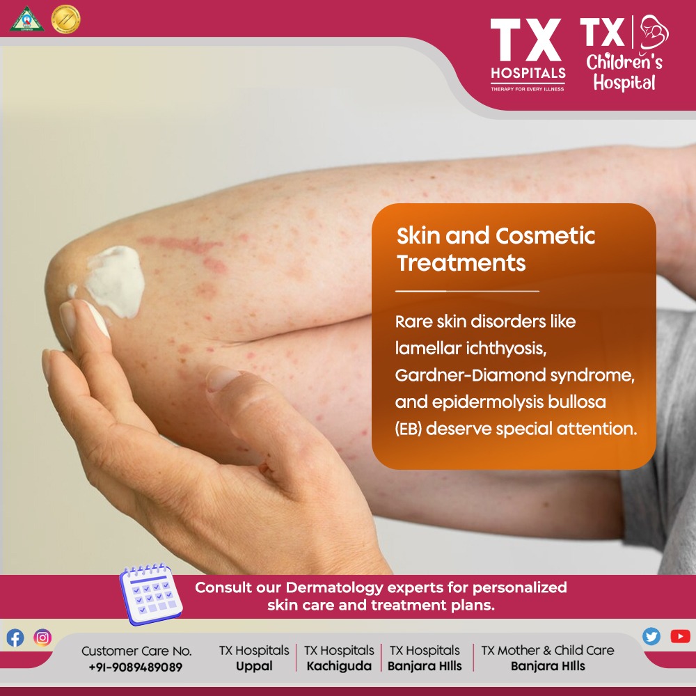 Get expert care for rare skin conditions like lamellar ichthyosis and EB. Consult our dermatologists for tailored treatments. Book Now: txhospitals.in/specialities/d… Call Now: 9089489089 #Skincare #Dermatology #CosmeticTreatments