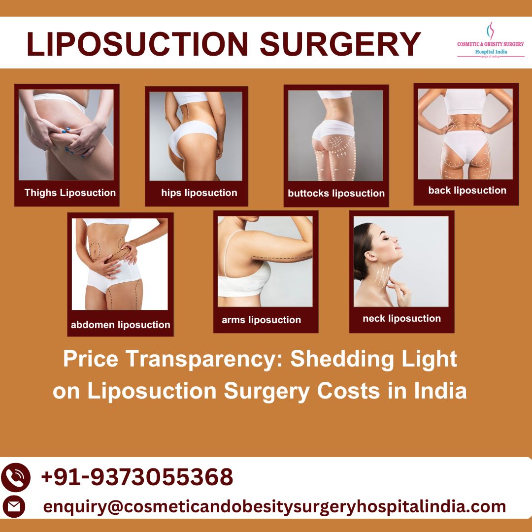 #Liposuction is a #plasticsurgery procedure that removes excess fat from the body. Also known as #lipo, #lipoplasty, or #bodycontouring, 

#liposuctionsurgery #cosmeticsurgery #lowcostliposuctionsurgery #abdomenoplasty #fatremovalsurgery

Read More On:- apsense.com/article/price-…