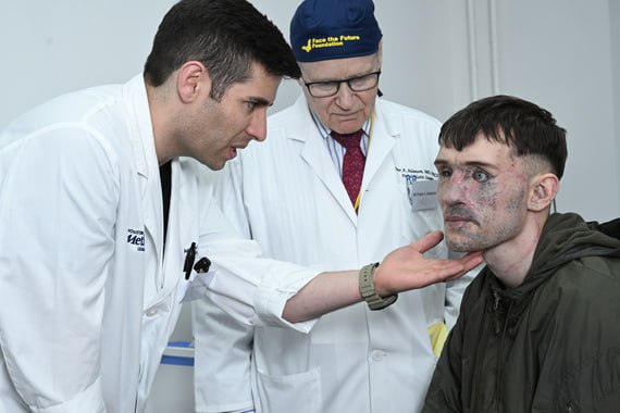 Doctors from Canada, the USA, and Ukraine have performed reconstructive surgeries on the faces and necks of 32 wounded Ukrainians as part of the third Face the Future Ukraine medical mission. Fifteen specialists came to Ukraine to perform complex surgeries. One of the 32…