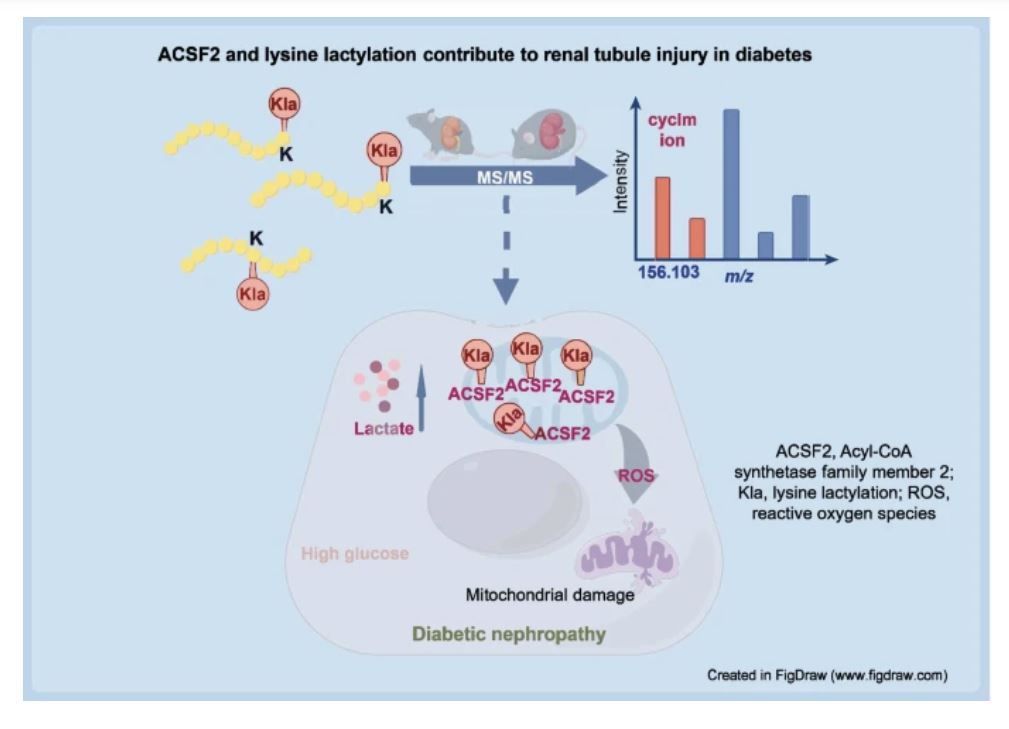 Lysine #lactylation may be involved in the pathogenesis of #DiabeticNephropathy, and ACSF2 and its lactylation may contribute to mitochondrial dysfunction of diabetic renal tubular cells. Henan Province Research Center for Kidney Disease tinyurl.com/bdk8w9y3