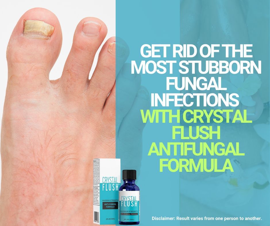 Tired of ineffective treatments? Crystal Flush Anti-Fungal Serum is here to rescue your nails! Our maximum strength Tolnaftate 1% formula targets the most stubborn fungal infections. Don't settle for drugstore brands that don't deliver. Order here → buff.ly/44jdTz8.