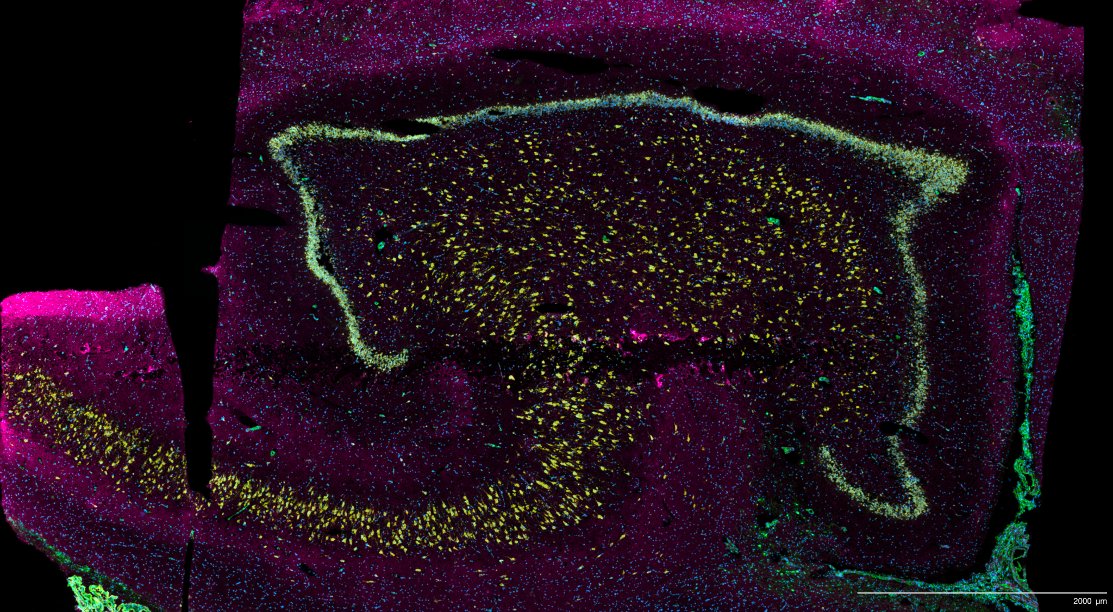From a recent #Xenium run @10xGenomics. And yes, the human hippocampus is, absolutely stunning. #FluorescenceFriday 🧠🔬🤩