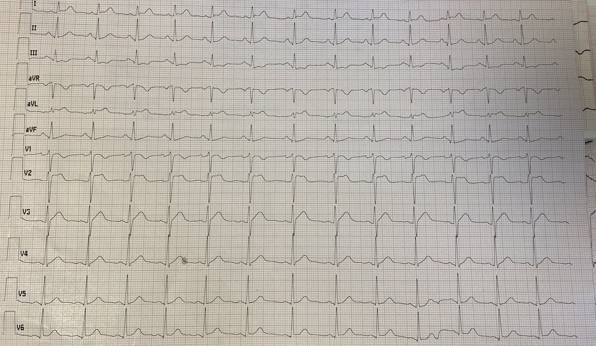 Javier Pérez Cervera tweet media