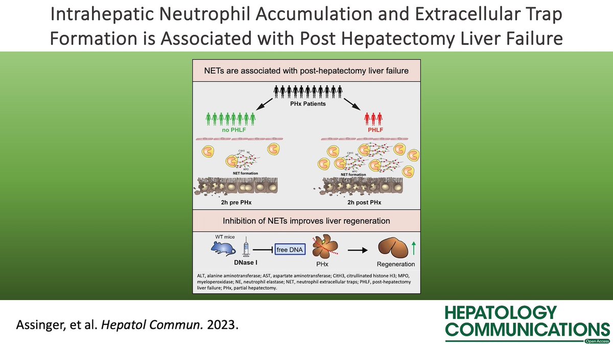 📑 Intrahepatic neutrophil accumulation and extracellular trap formation are associated with posthepatectomy liver failure 💥Inhibiting NETs accelerates liver regeneration! Could this be a game-changer for post-hepatectomy liver failure⁉️ #LiverTwitter journals.lww.com/hepcomm/fullte…