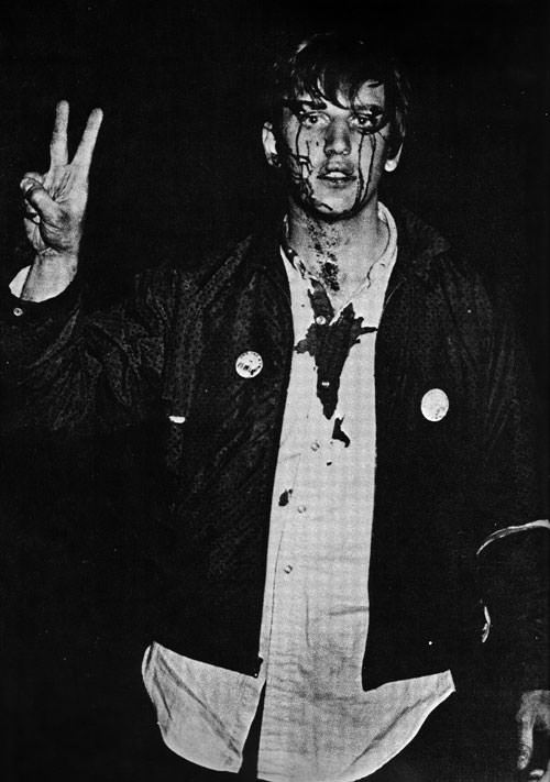 columbia student flashes the peace sign after being beaten by riot police at an antiwar demonstration, april 1968