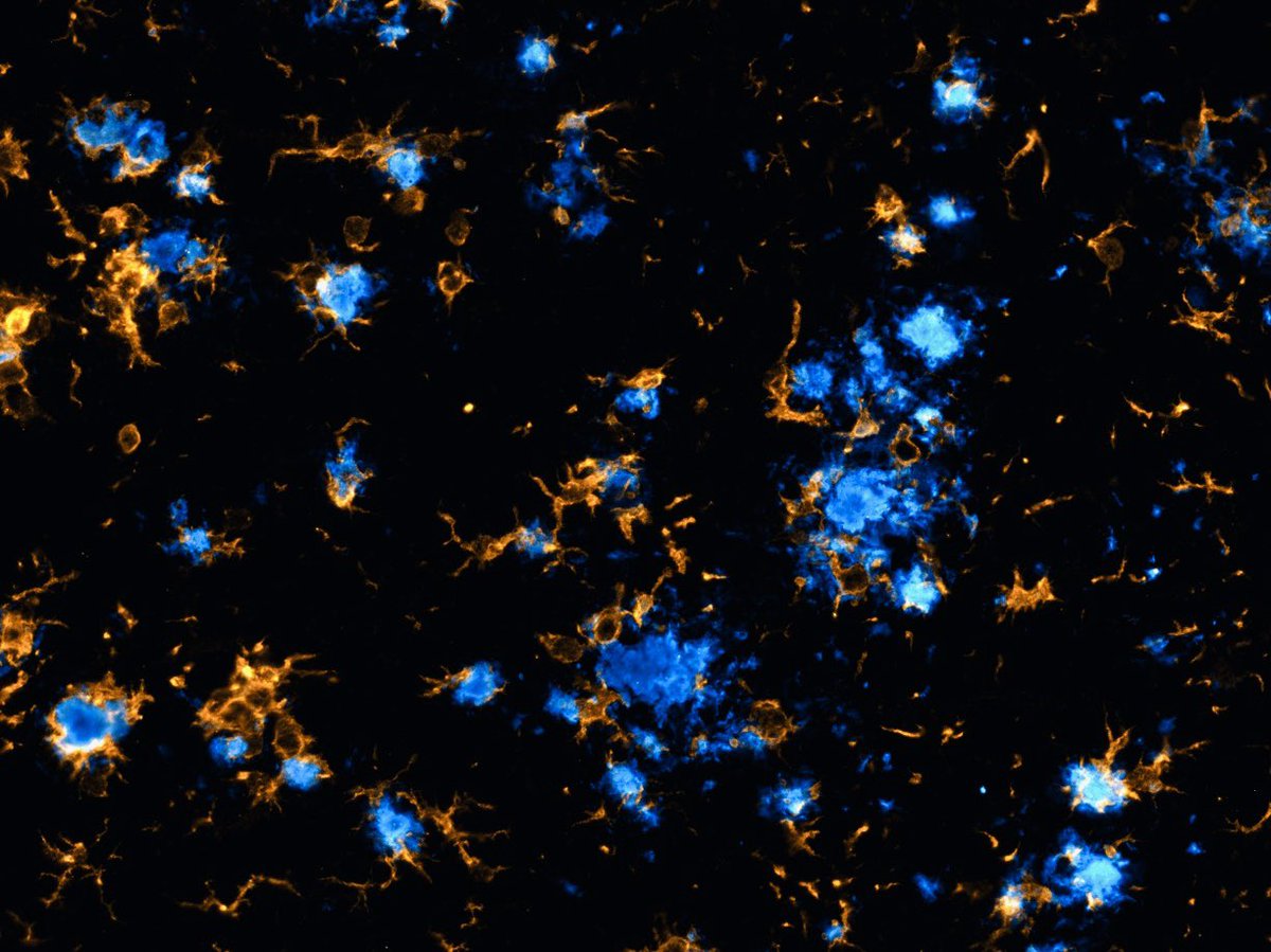 Microglia (🟡) and Aβ plaques (🔵) in the thalamus of a 1-year-old 5xFAD mouse. Whenever I look at these images, I wonder if microglia are attracted to plaque areas because they: 1) further deposit Aβ into plaques, 2) attempt to degrade plaques, or 3) both. #FluorescenceFriday