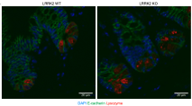 📢 Two new preprints alert! LRRK2-a kinase associated with #Parkinson’s and #crohn's  #IBD. But where is it expressed and active? Not in Paneth cells, important for Crohn’s, but IL-4 induced in B cells, and other immune cells- see tinyurl.com/mwz4py7u tinyurl.com/mpvfhw44