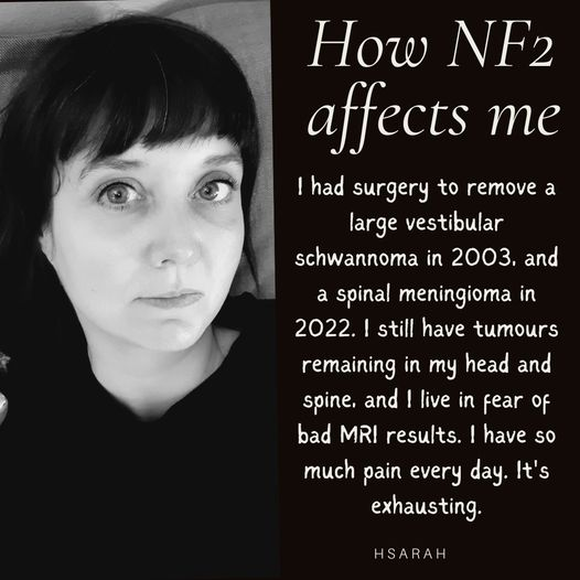 Real people affected by NF2 are sharing their journeys,
Today we meet Sarah whose NF2 journey is blighted by chronic pain.
NF2 is for life, an unwavering companion. There is no cure. Instead, there is resilience, determination, and a shared journey among those who navigate #NF2