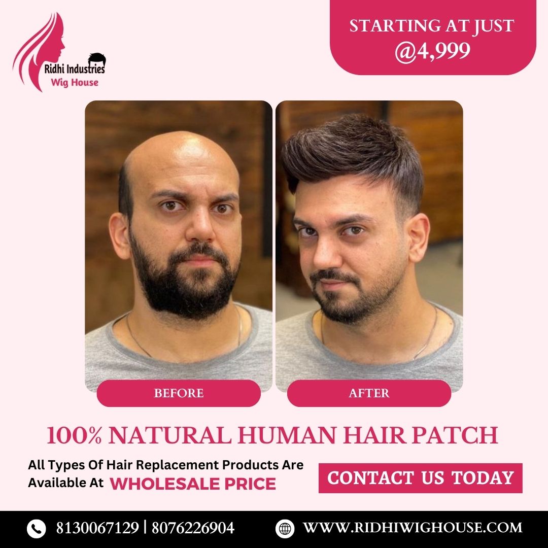 Try our Top-quality Hair Patches Starting At Just �INR 4999/-  

#wigs #hairwigs #humanhairwigs #wholesaler #besthairwigs #naturalhairproducts #nonsurgicalhairreplacement #hairlossreplacement #besthairwigs #wigwholesaler #bestwigs #ridhiwig #ridhiwighouse #ridhiindustries