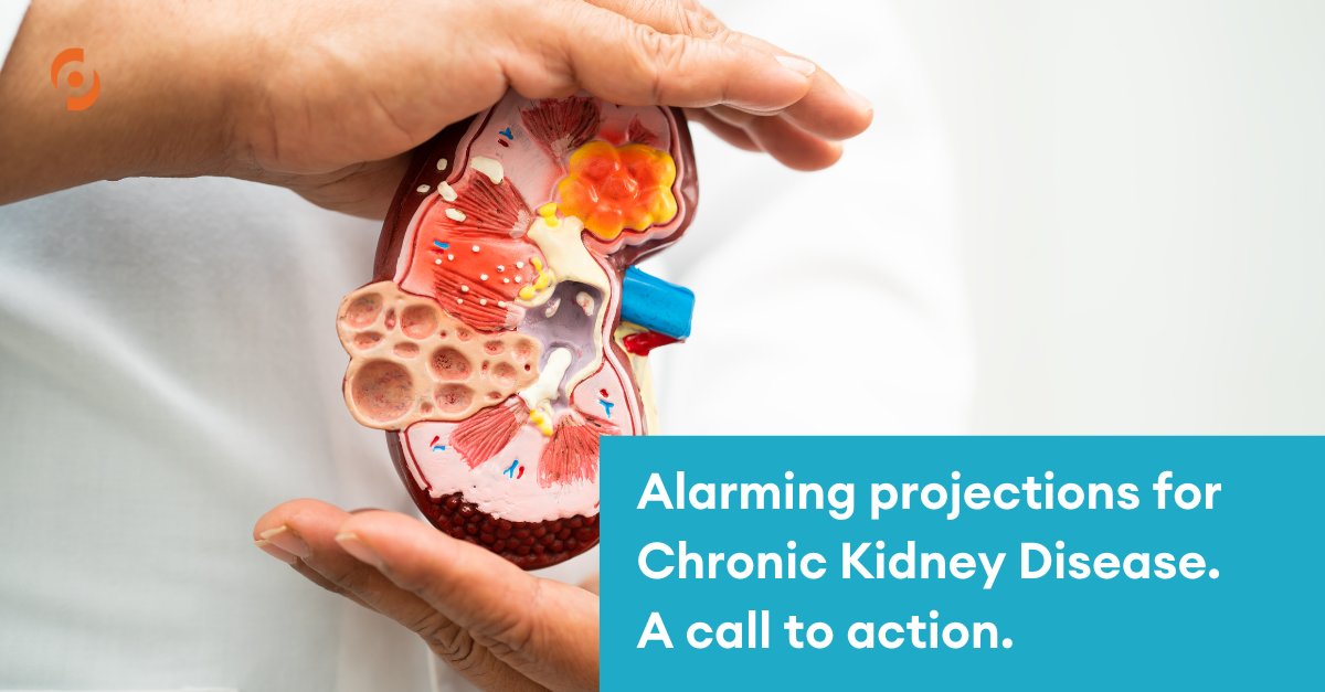 Alarming projections for #CKD by 2032 with new research released by @astrazeneca We need to raise awareness & take action! Learn more here: outsourcing-pharma.com/Article/2024/0… #KidneyHealth #PublicHealth #NewResearch #Diaverum #Truecare