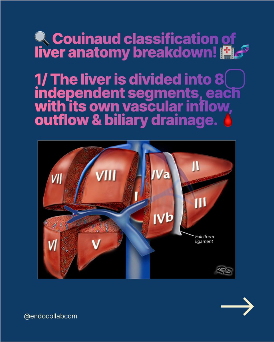 🔍 Couinaud classification of liver anatomy breakdown! 🏥🧬

1/ The liver is divided into 8️⃣ independent segments, each with its own vascular inflow, outflow & biliary drainage. 🩸