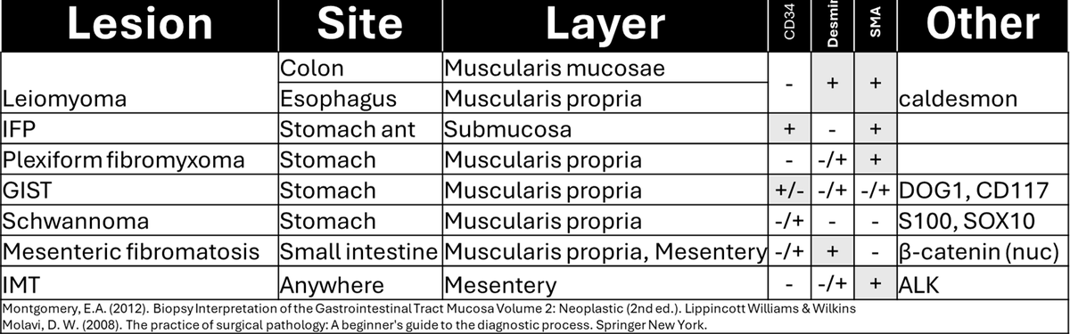 DrCycloPath's tweet photo. ❌IFP: stomach antrum, submucosa, onion skin vessels, eos, +SMA
❌Glomus tumor: stomach, muscularis propria, round cells, distinct cell borders, +SMA
✅Plexiform fibromyxoma: stomach, muscularis propria, plexiform fibromyxoid nodules, hypovascular, +SMA
#GIPath #PathTwitter #pathology #BSTPath