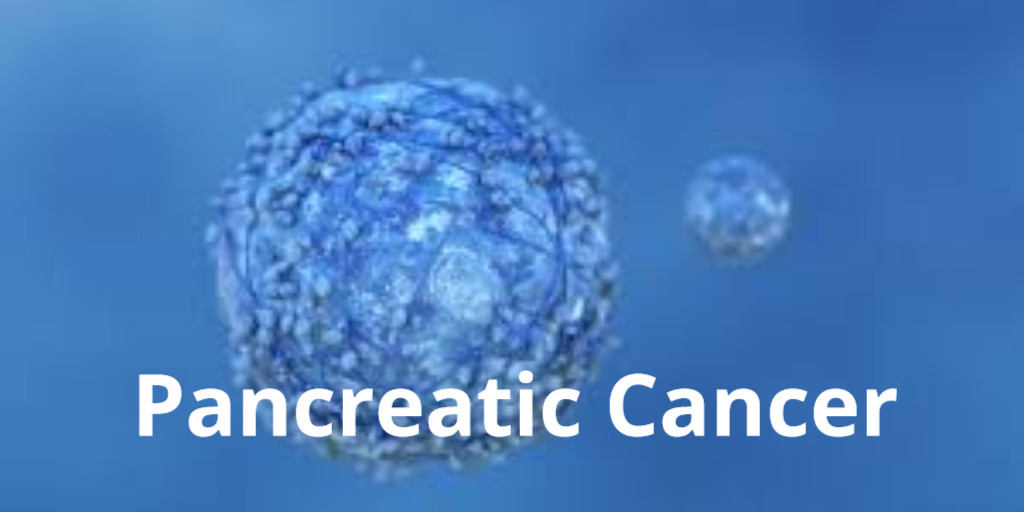 Pancreatic Cancer Is Difficult to Treat. University of Wisconsin Researchers Think Nano-drugs Hitching a Ride on Bacteria Could Help - please check the link for more ow.ly/JIzE50RvzfF @UWMadison #NanoDrugs #PancreaticCancer #CancerResearch #RareDiseases