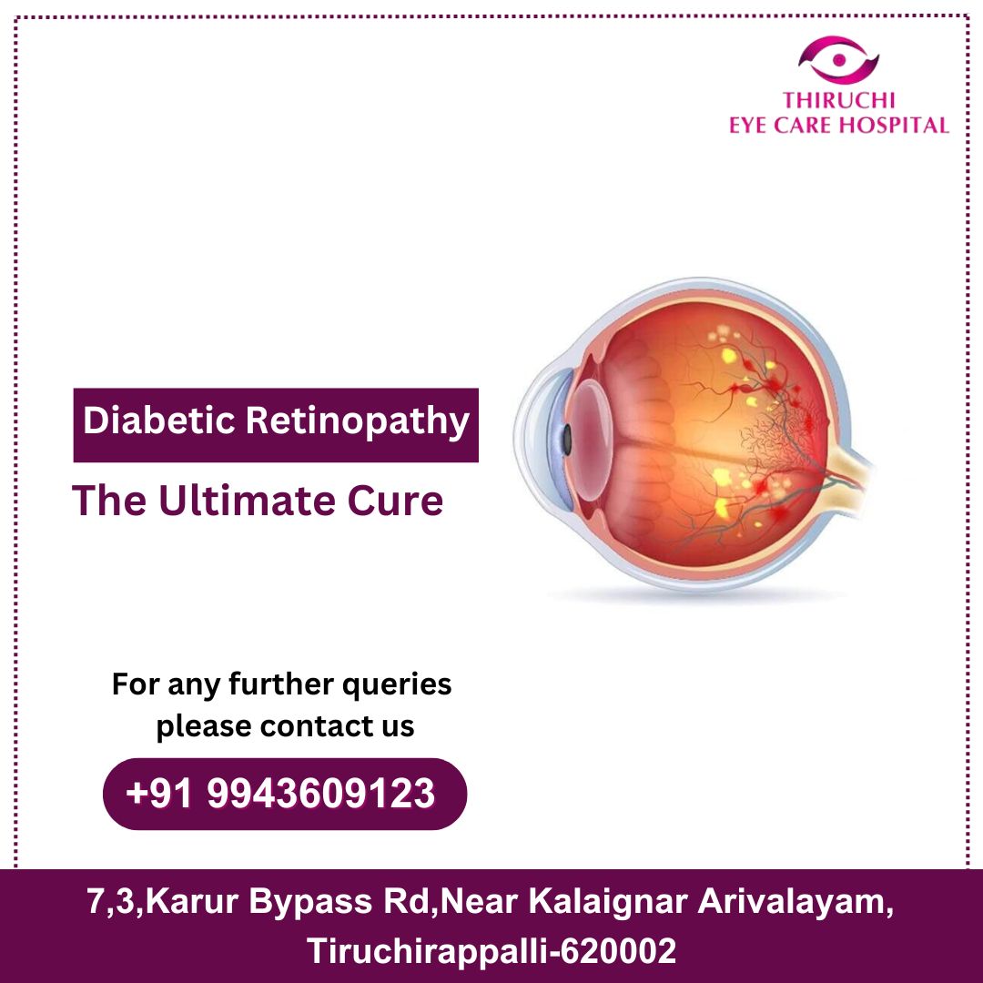 Visionaries in Retinopathy Care: Restoring Clarity, Renewing Hope

For consultations, Thiruchi Eye Care Hospital.

Phone No: '+919943609123.

#diabeticretinopathy #eyehealthcare #eyetreatment #thiruchieyecarehospital #besteyehospitalnearme #besteyehospitaltrichy #eye #trichy