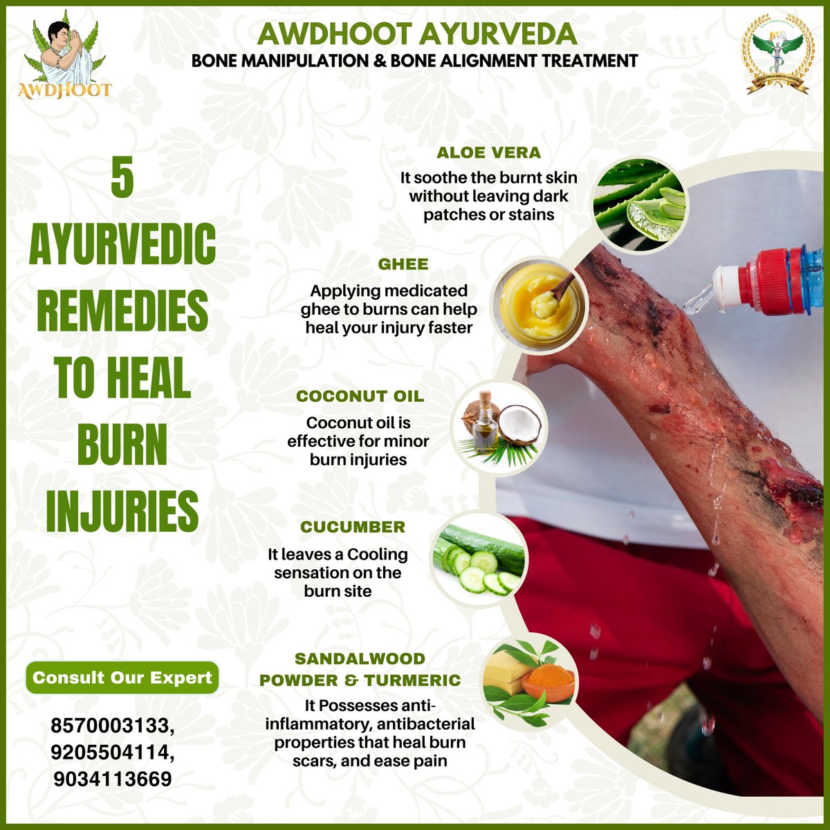 These 5 Ayurvedic Remedies To Heal Burn Injuries!
1.Aloe vera
2.Ghee
3.Coconut Oil
4.Cucumber
5.Sandalwood Powder & Turmeric
.
.
#awdhoot #burninjury #skinburntreatment #ayurveda #naturalhealing #ayurvedicremedies #skincaretips