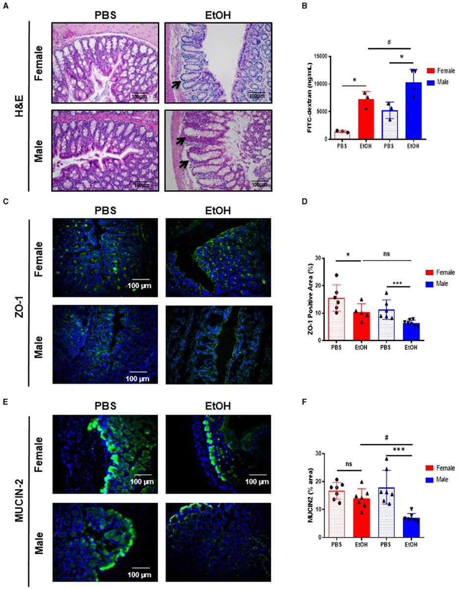 Fecal microbiota transplantation from female donors restores gut permeability and reduces liver injury and inflammation in middle-aged male mice exposed to alcohol frontiersin.org/articles/10.33… | @FrontNutrition