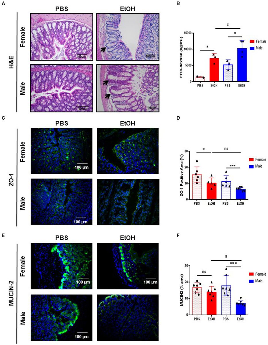 Agingdoc⭐David Barzilai🔔MD PhD MS MBA DipABLM🩺 (@agingdoc1) on Twitter photo Fecal microbiota transplantation from female donors restores gut permeability and reduces liver injury and inflammation in middle-aged male mice exposed to alcohol
frontiersin.org/articles/10.33… | <a href="/FrontNutrition/">Frontiers - Nutrition</a> Fecal microbiota transplantation from female donors restores gut permeability and reduces liver injury and inflammation in middle-aged male mice exposed to alcohol
frontiersin.org/articles/10.33… | <a href="/FrontNutrition/">Frontiers - Nutrition</a>