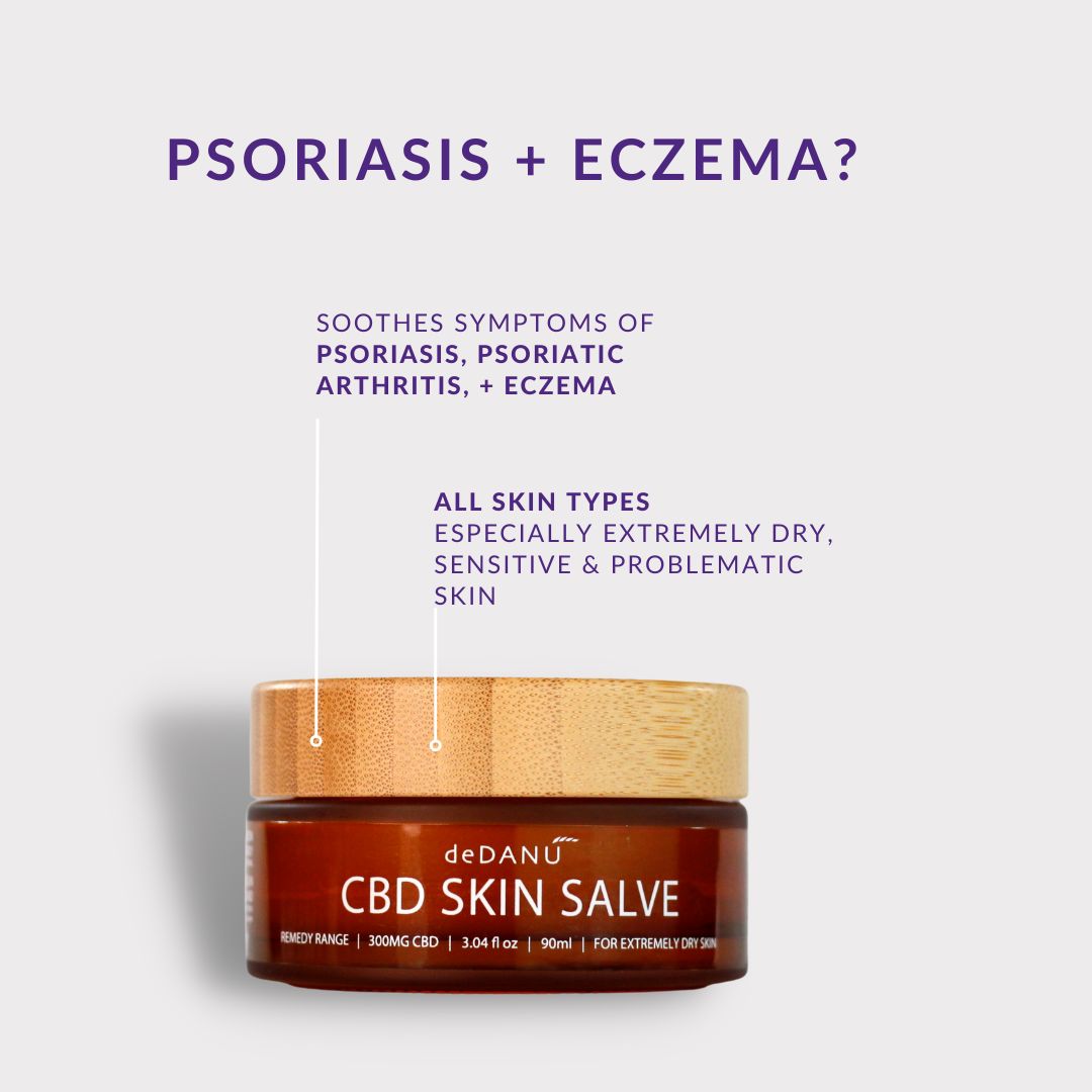 Struggling with psoriasis or eczema? Say hello to your new skincare hero – CBD Skin Salve!🌿 Whether you're dealing with flare-ups or seeking ongoing maintenance, this salve offers relief without harsh chemicals or additives.🧴🌿✨ #deDANÚ #CBDheals
