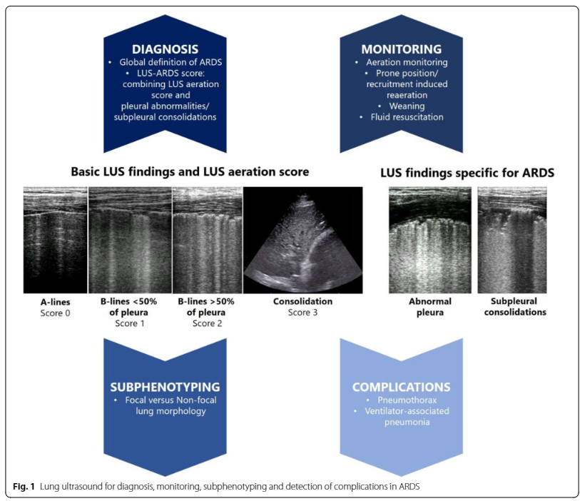 1/ <a href="/yourICM/">Intensive Care Medicine</a>'s latest manuscripts of the topical collection "ICU Toolbox":

🔹Lung ultrasound for diagnosis and management of ARDS 👉 rdcu.be/dGeRp
🔹Prone positioning 👉 rdcu.be/dGeRj
