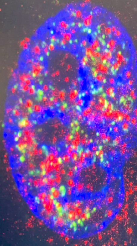 Wrapping up cell imaging today 🧫 Hoping for results that exceed expectations! Huge thanks to my supervisor <a href="/ChrisToseland/">Chris Toseland</a>, <a href="/RCatHarwell/">Research Complex at Harwell</a> and  <a href="/CLF_STFC/">Central Laser Facility</a>  for this opportunity 🙏 #Science #Research