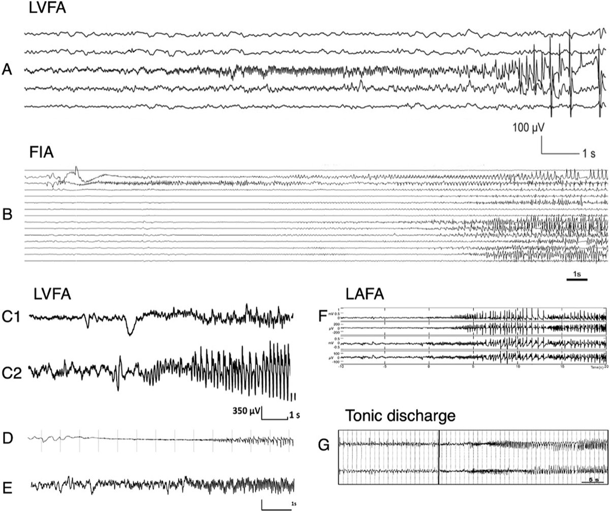IFCN and its Clinical Neurophysiology journals tweet media