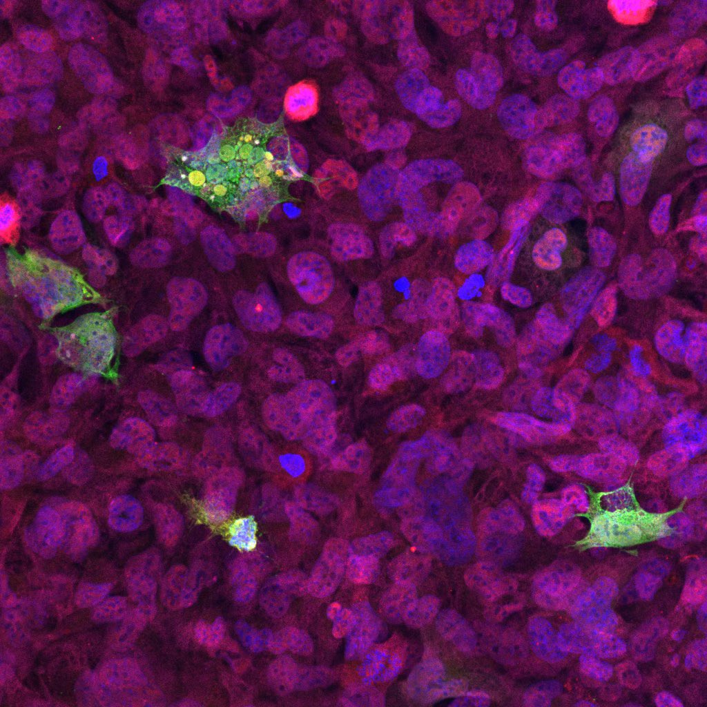 Happy Fluorescence Friday! 🧪

GFP stained human microglia! 🤓

#fluorescencefriday
#microscopy 
#neuroscience