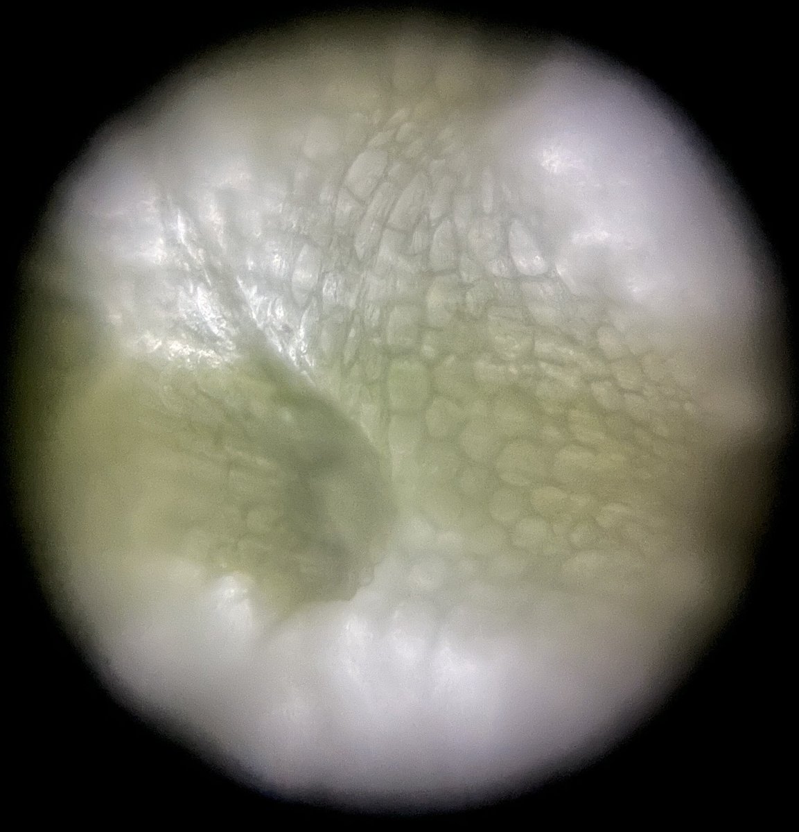 Adventures In Microscopy: The MicroRealms Projector!!

Pictures of asparagus stem cross sections with diff stains using the Foldscope 2.0 & the NEW MicroRealms Projector. Can you tell which is which?

1/7 No Stain

#FearlessMicroscopy #ScienceIsFun #ScienceIsBeautiful