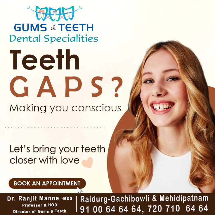 To book your appointment contact us at: 9100646464, 7207106464

#GumsandTeethDentalSpecialities #ToothExtractions #Fillings #DentalImplants #TeethWhitening #BestDentalDoctorInHyderabad #DrRanjithManne   #DentalHealth #SmileMakeover #OralCare #ImplantDentistry #HealthyTeeth