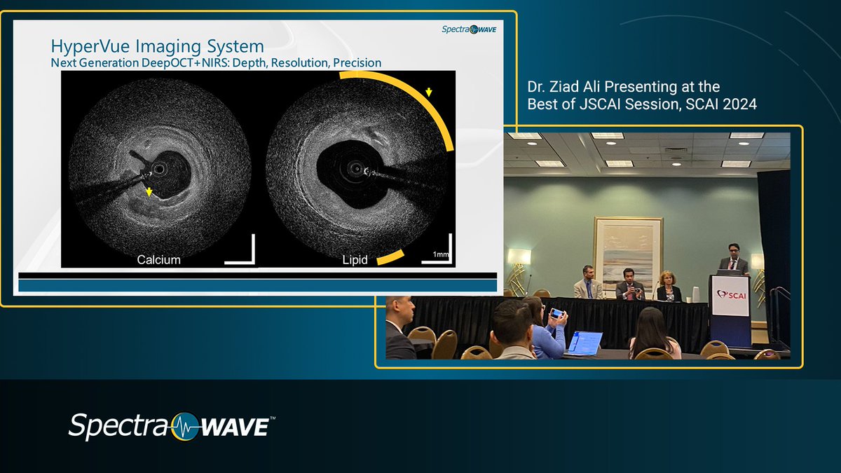 Thank you to @ziadalinyc for his presentation of #DeepOCT+NIRS in the Best of @MyJSCAI session at #SCAI2024. 

Learn more by visiting the SpectraWAVE team at #SCAI2024 booth #411 to see a demo, or visiting our website spectrawave.com!