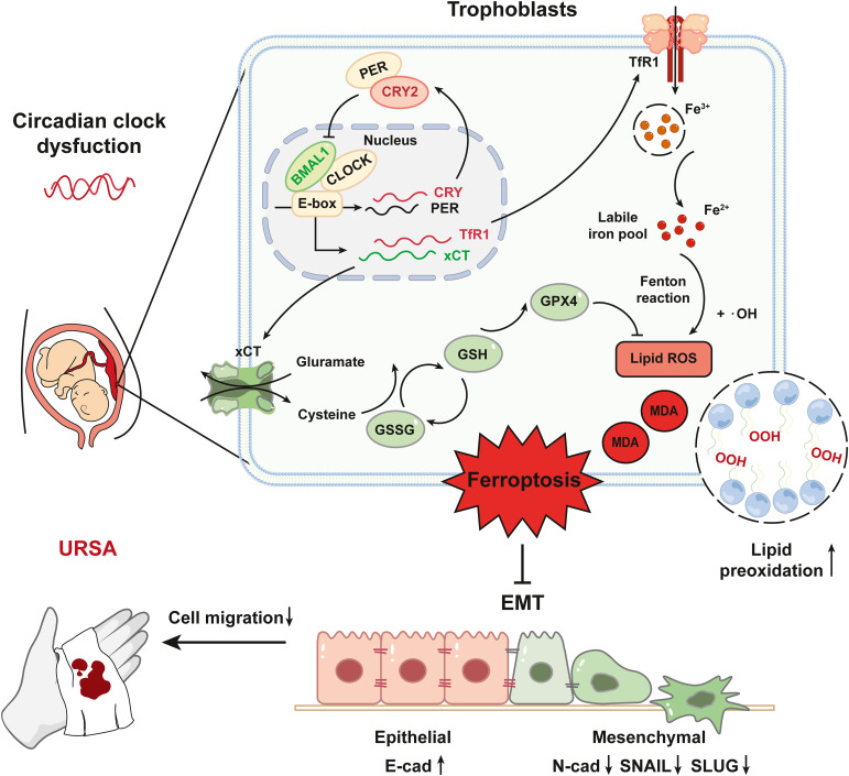 #ArticleinPress: Cryptochrome 2 Suppresses Epithelial-Mesenchymal Transition by Promoting Trophoblastic #Ferroptosis in Unexplained Recurrent Spontaneous Abortion.

Full text: ajp.amjpathol.org/article/S0002-…