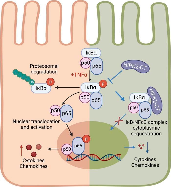 HIPK2 C-terminal domain inhibits NF-κB signaling and renal inflammation in kidney injury: buff.ly/3JDesKH @CijiangHe @IcahnMountSinai #Nephrology