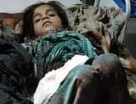 چمے بہ بیت پہ گندگ ءَ
گوشے بہ بیت پہ اِش کنگ
.
#StopBalochGenocide 
#StopMilitaryOprationsInBalochistan