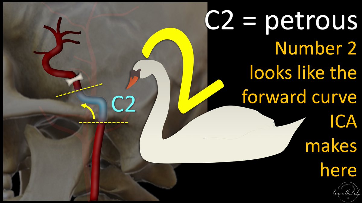 4/C2 is the petrous or horizontal segment. This is where the ICA gets to the next floor, the skullbase. I remember this b/c the ICA makes a curve forward here, like a swan’s neck--and number 2 has a forward, swan like curve that looks just like the curve of the petrous segment.