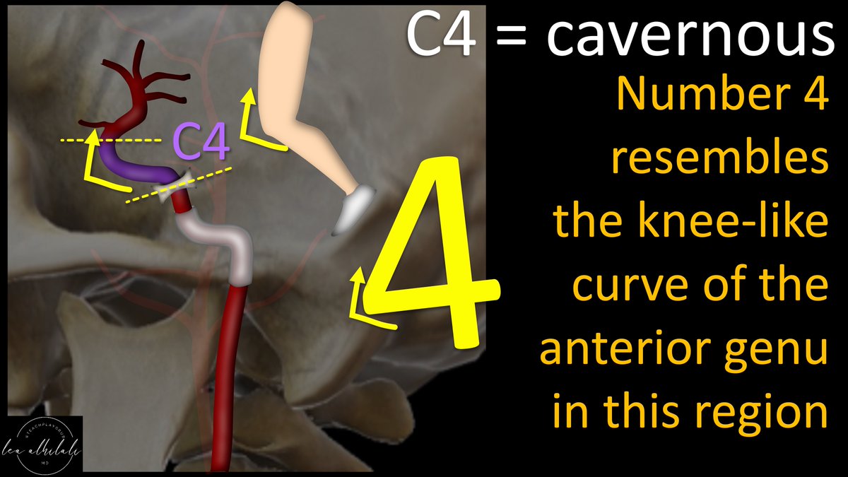6/C4 is the cavernous segment Cavernous segment has the anterior genu. Here, the ICA makes a curve back, so it looks like a knee (genu is Latin for knee) You can remember C4 is cavernous b/c the number 4 has a curve back like the anterior genu of the cavernous ICA, like a knee.