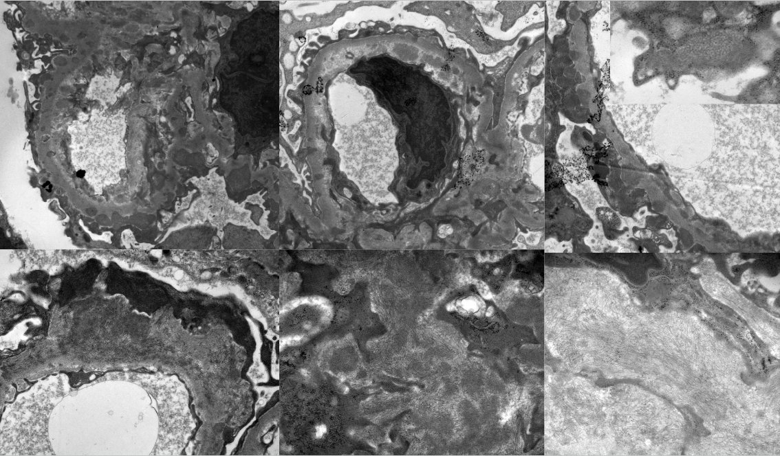 JZRenalPath tweet picture