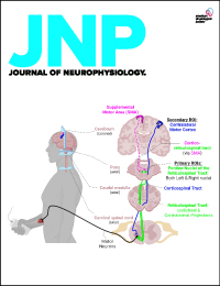 What is a #SystematicReview? A systematic review answers a defined research question by collecting and summarizing all empirical evidence that fits pre-defined criteria. Get to know @JNeurophysiol's article types➡️ow.ly/VoQ850Rmc0W #Neurophysiology #Neuroscience