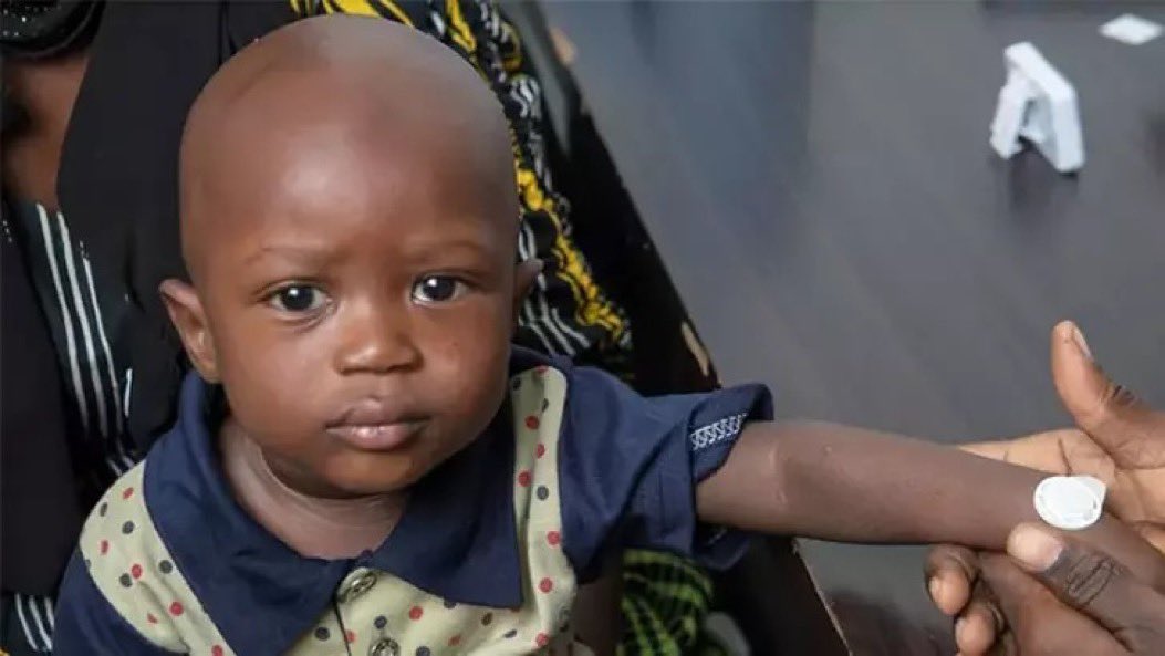 🔴 Il a été annoncé que les résultats du vaccin contre la rougeole et la rubéole appliqués aux enfants en Gambie étaient concluants.

▪️ Les scientifiques ont déclaré que les enfants vaccinés avec le patch présentaient le même niveau d'immunité qu'avec l'administration d'une…