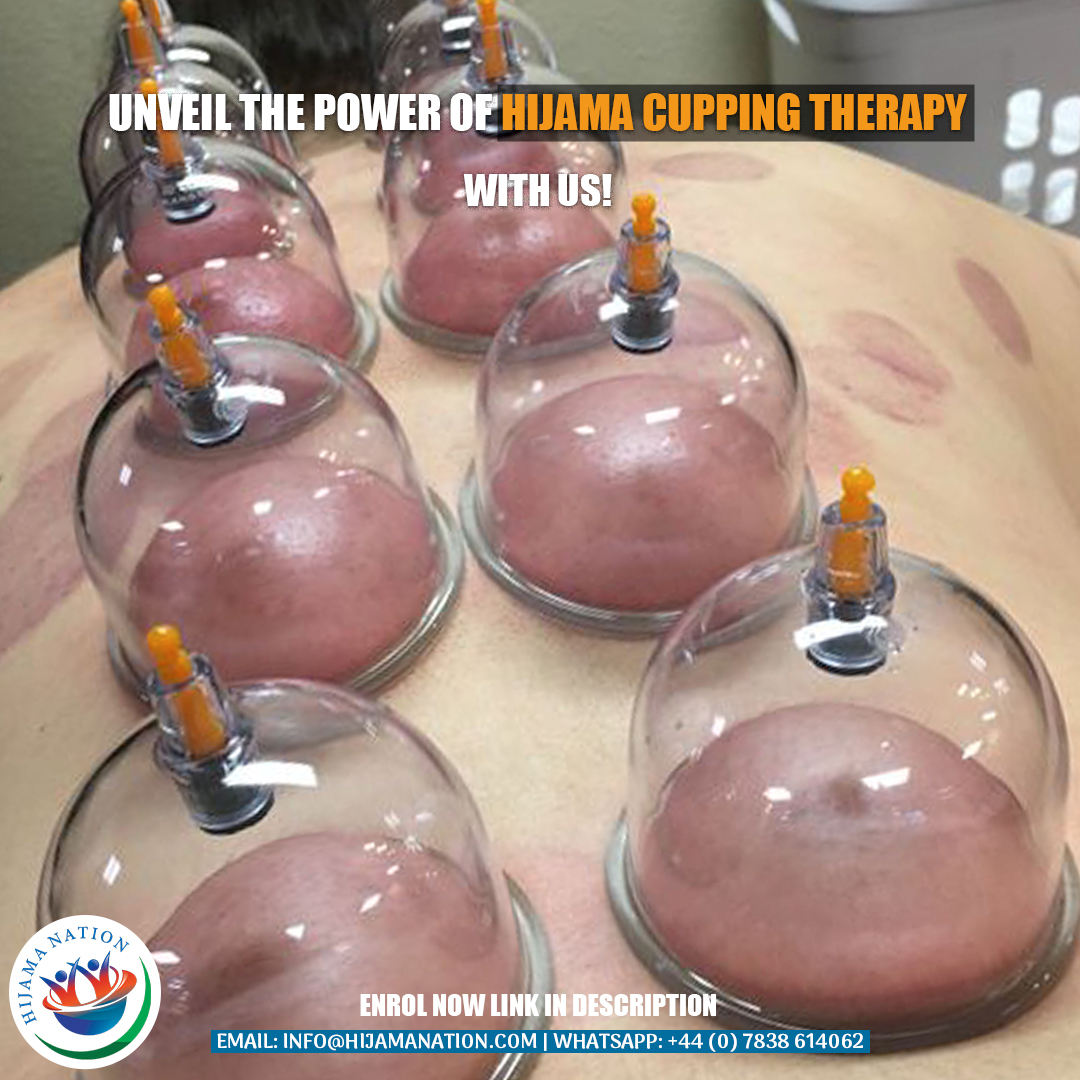 Start your own Hijama Business/Clinic by getting certified in Hijama Cupping Therapy.

register.hijamanation.com/tw-webinaroptin

Watch a FREE webinar about the potential of learning Hijama Cupping Therapy 

#HijamaNation
#HijamaTraining
#CuppingTherapy
