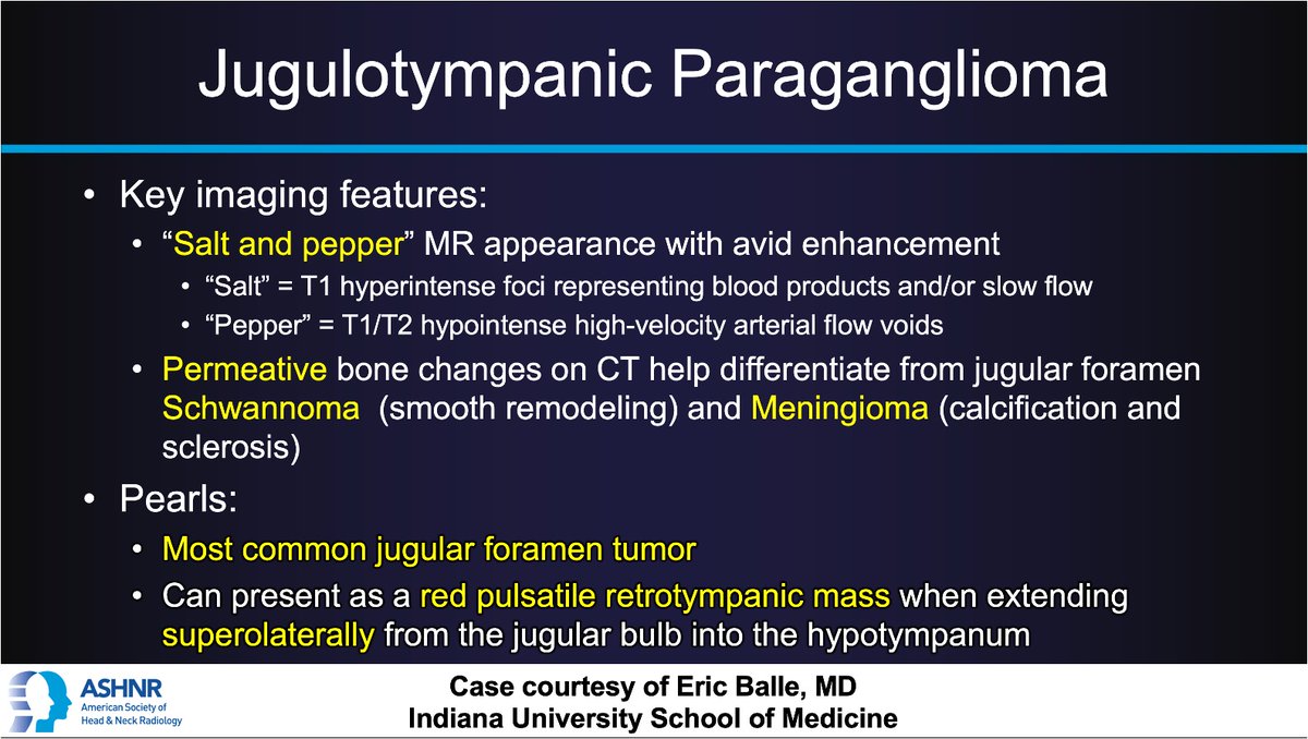 #ASHNRCOTW #251: ANSWER. Thx @Eric_Balle1 + @IURadiology 4 case! #ASHNR24 @callyrobs @DShatzkes @CDP_Rad @rhwiggins @nakoontz @KRileyMD @CMGlastonbury @cmtomblinson @tabby_kennedy @PhilipRChapman1 @MohitAgNeurorad @AshokSrini15 @WmOBrienDO @CynXinWu @kmmosier @RadRupa