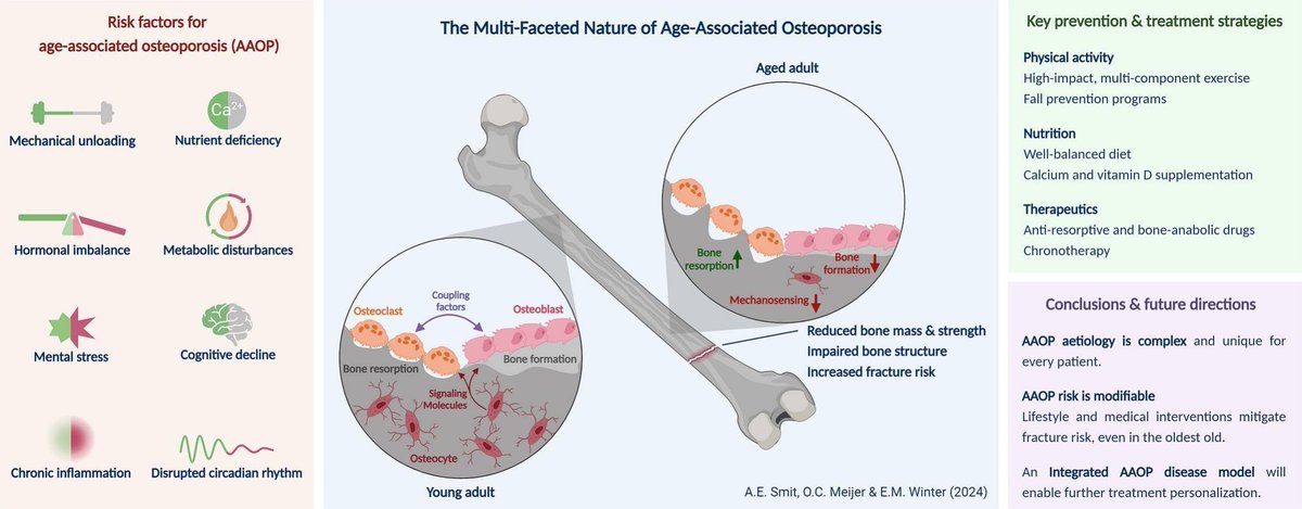 #Bone Reports' Early Career Researcher Board has selected their favorite Review Article for Volume 20 🥁🥁🥁 Congratulations @annelies_smit Onno Meyers and @liesbeth_winter! The multi-faceted nature of age-associated osteoporosis Full OA Article ⬇️⬇️⬇️ sciencedirect.com/science/articl…