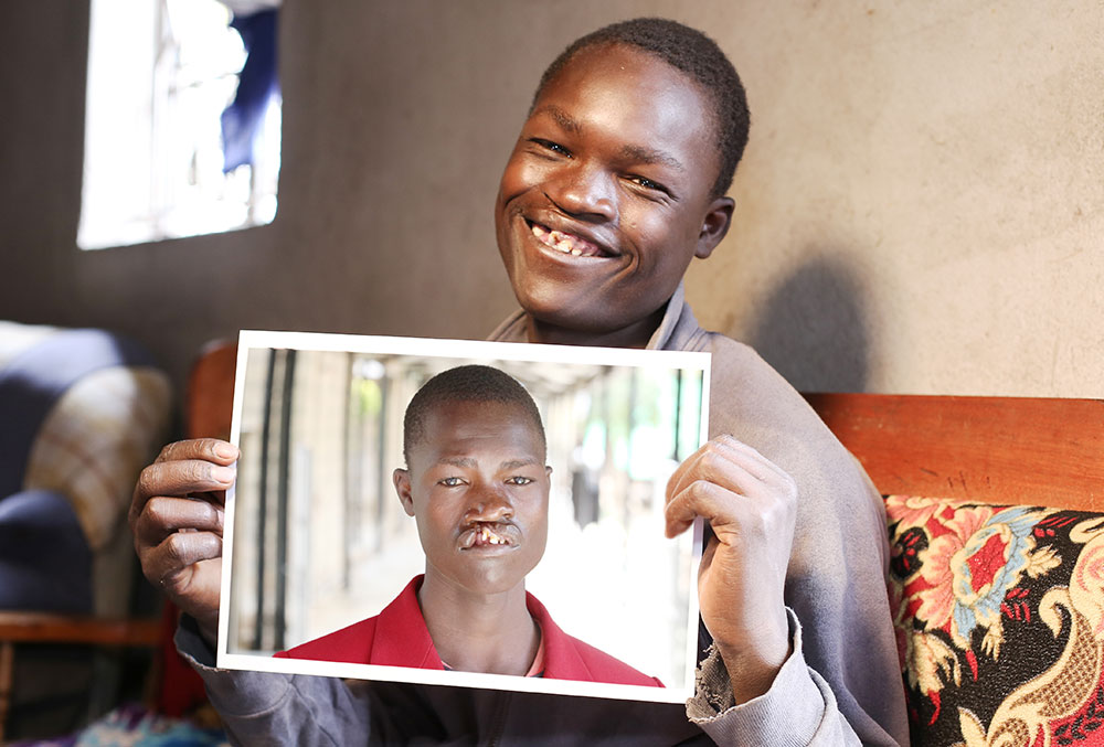 Next up, we're highlighting our work in Kenya! 🇰🇪 We've helped over 11,600 cleft-affected patients receive life-changing cleft care. Help change more lives by donating this #CleftLipAndPalateAwarenessWeek: tinyurl.com/2m6et6xw