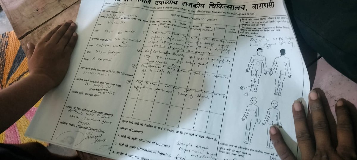 @Uppolice @dgpup @IgRangeVaranasi @adgzonevaranasi महोदय जी संज्ञान में लेते हुए कार्रवाई सुनिश्चित करने हेतु आग्रह बुरी तरह मारा गया सर फोड़ दिया गया लेकिन @varanasipolice थाना पाण्डेयपुर क्षेत्र की घटना आरोपी फिर भी खुल में गुम रहा है