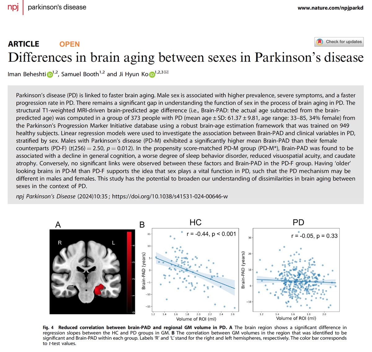 Really excited about our recent paper published in one of the top journals in the area of Parkinson's disease (npj Parkinson's Disease), which investigates sex differences in PD using brain age measures. Link: nature.com/articles/s4153…
@Nature_NPJ, @umanitoba, @um_research