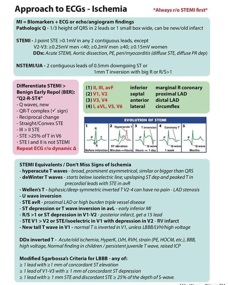 🔴 Approach to ECGs - Ischemia

#MedX #MedTwitter #CardioTwitter
#medx #medEd #MedTwitter #MedEd #cardiotwitter #FOAMed #CardioEd #Cardiology #MedEd #ENARM #cardiotwiteros #meded #cardiology #CardioTwitter #CardioEd #medtwitterWhat