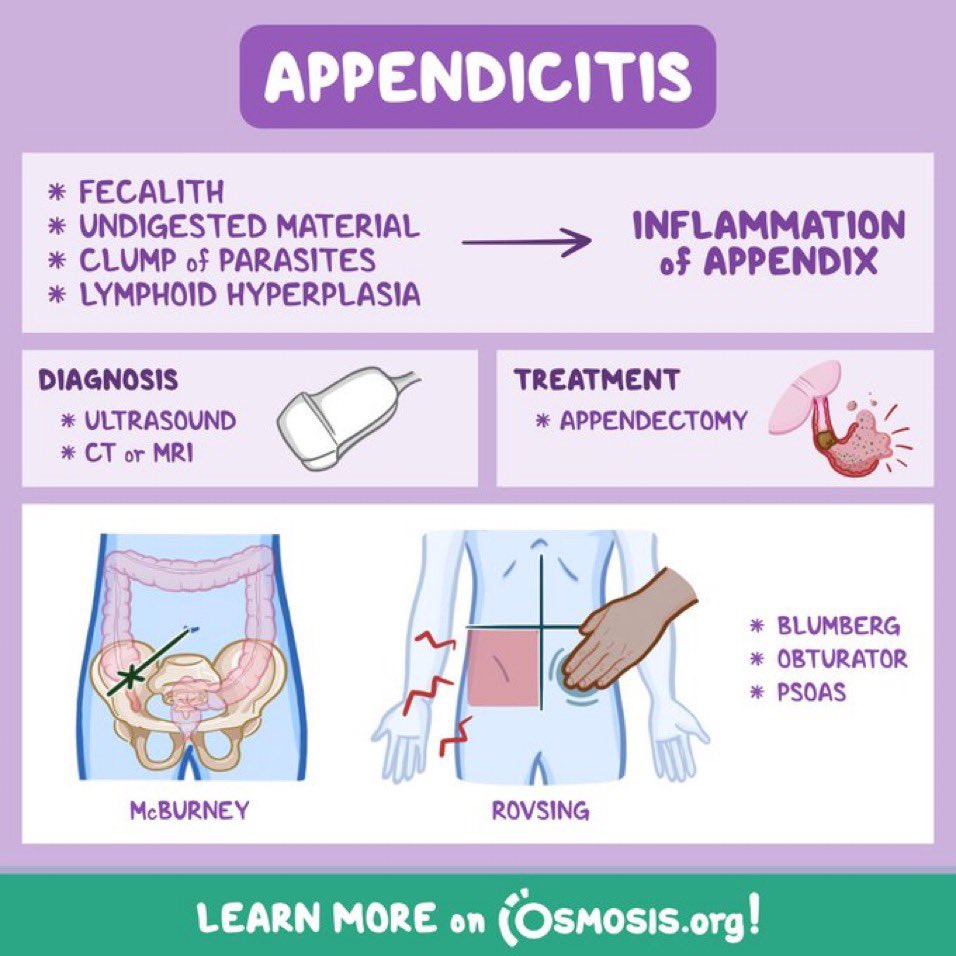 Appendicitis

@OsmosisMed #MedEd #MedX