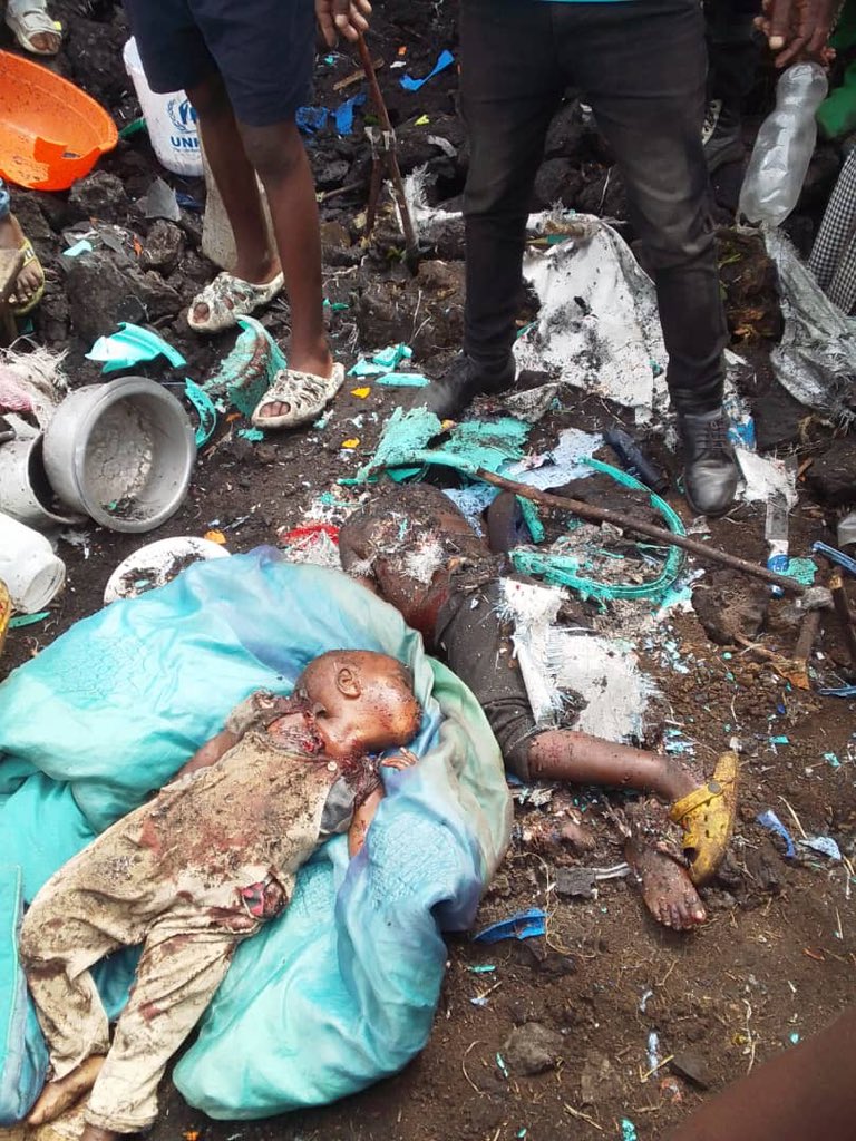 Here is the outcome of the bombs that were drop by arms men who are sponsored by the West in other to control the resources of Eastern Congo. The bombs were drop in displaced families camp in the Mugunga district in the city of Goma, DR Congo.